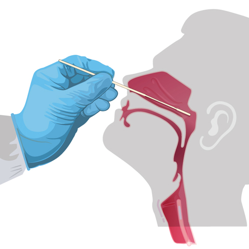 COVID-19 Nasal Swab Test Does Not Cause Risk of Infection ...