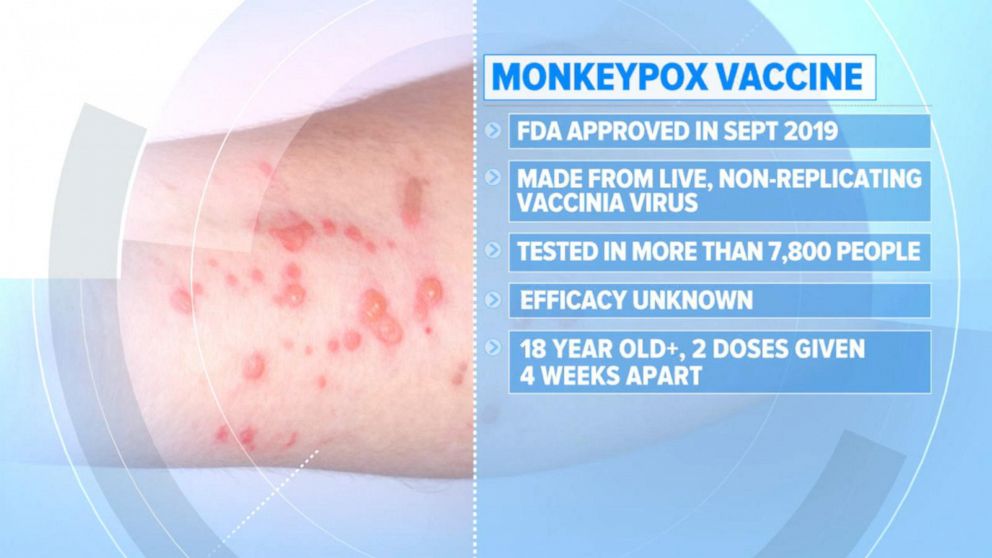 PHOTO: What to know about monkeypox as the virus continues to spread in the United States.