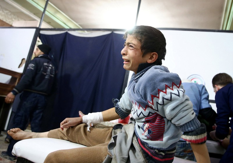 A wounded boy reacts in a hospital in Douma after an airstrike on the rebel-held town of Mesraba, in the rebel-held besieged town of Douma, eastern Ghouta in Damascus