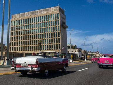 Doctors identify brain abnormalities in Cuba attack patients