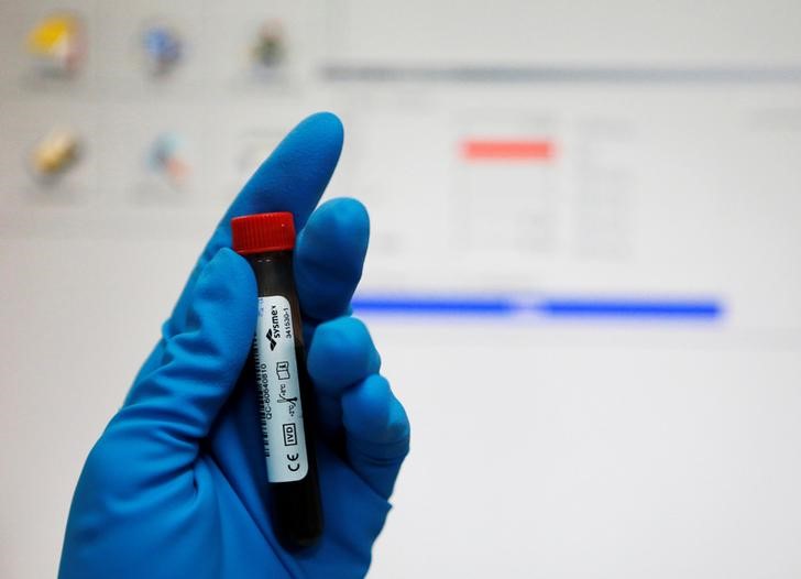 FILE PHOTO: A technician holds a test tube with a blood sample at the Russian anti-doping laboratory in Moscow