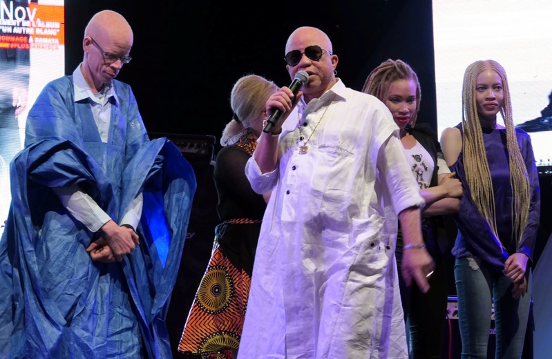 Malian musician Salif Keita performs during a concert to promote tolerance and remember Ramata Diarra, an albino girl who was kidnapped and brutally murdered this year, in Fana