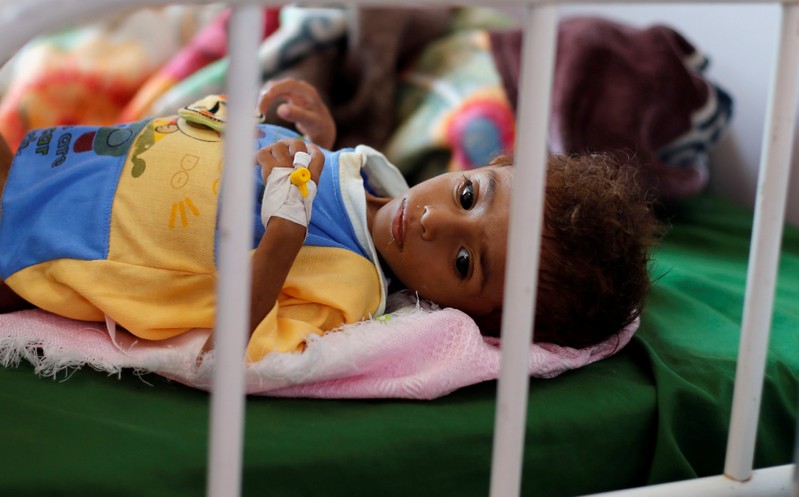 Malnourished boy lies on a bed at a malnutrition treatment center in Sanaa, Yemen