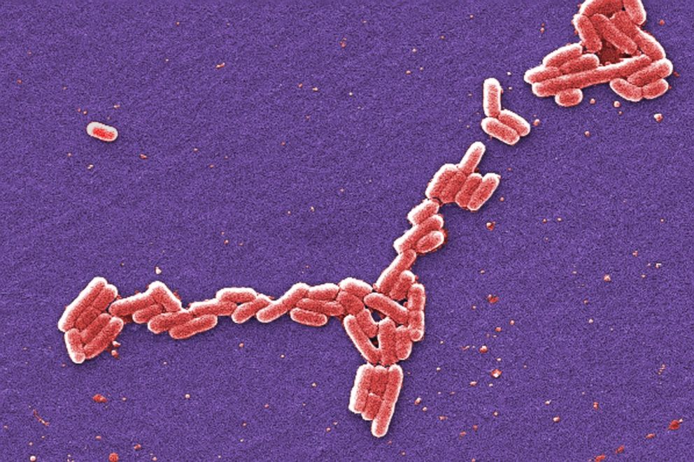 This colorized 2006 scanning electron microscope image shows E. coli bacteria of the O157:H7 strain that produces a powerful toxin which can cause illness.