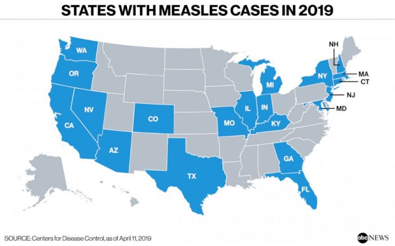 Staggering number of measles cases in US just part of 300% global uptick