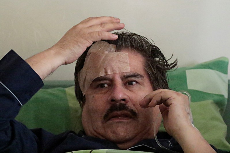 Waldo Albarracin member of CONADE (Democracy Defense Commmitte) and Rector of Higher University of San Andres is seen after he was injured during a protest against election results in La Paz