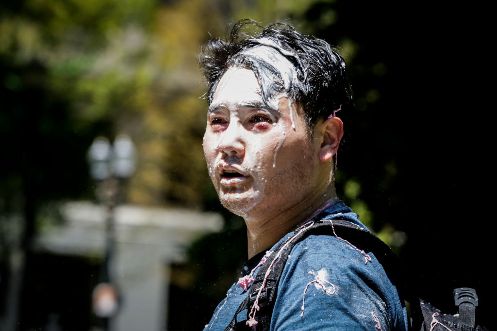 PORTLAND, OR - JUNE 29: Andy Ngo, a Portland-based journalist, is seen covered in unknown substance after unidentified Rose City Antifa members attacked him on June 29, 2019 in Portland, Oregon. Several groups from the left and right clashed after competing demonstrations at Pioneer Square, Chapman Square, and Waterfront Park spilled into the streets. According to police, medics treated eight people and three people were arrested during the demonstrations. (Photo by Moriah Ratner/Getty Images)