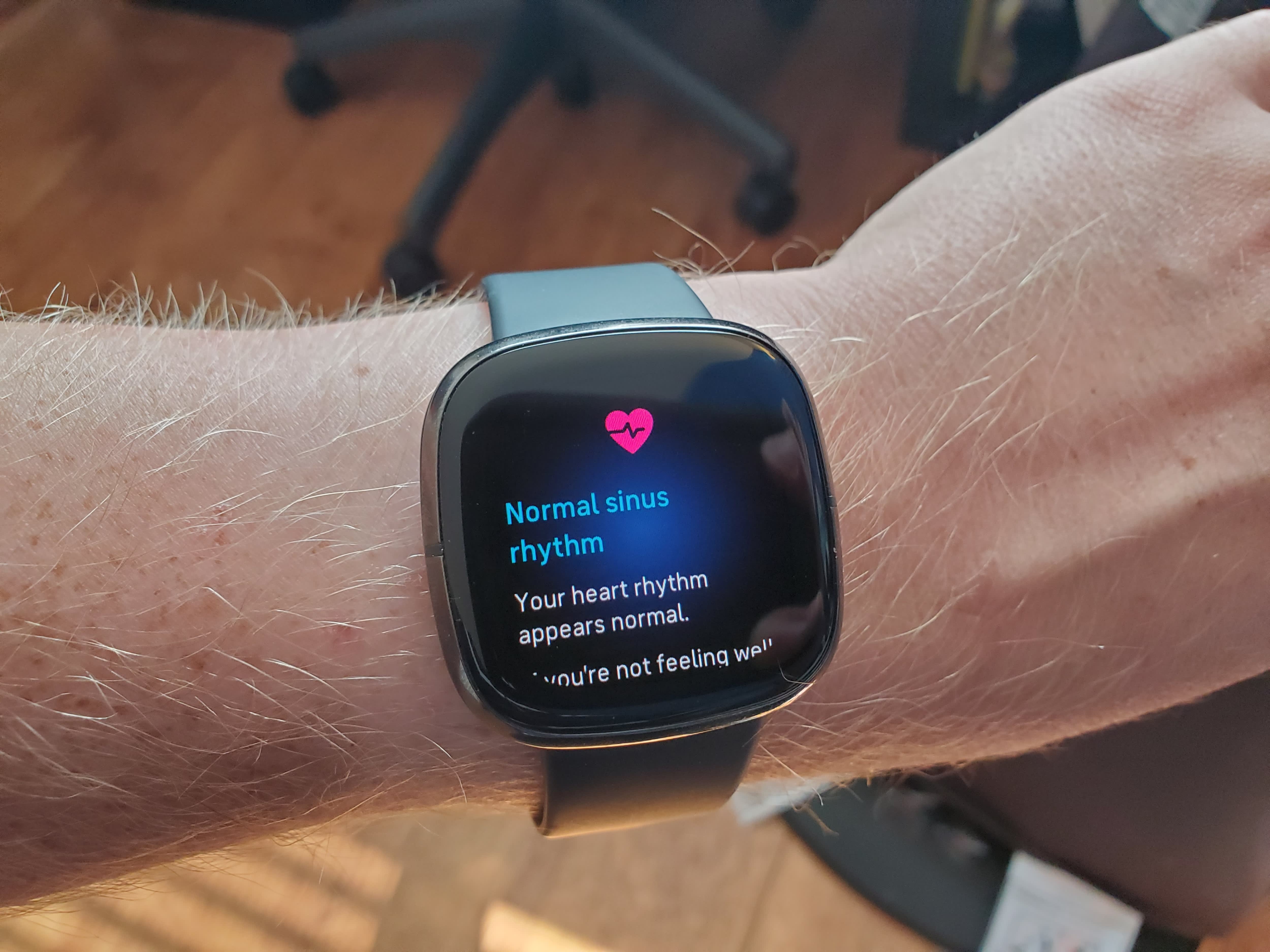 Fitbit Sense smart watch on arm of a man, showing ECG heart health function, San Ramon, California, October 8, 2020. (Photo by Smith Collection/Gado/Getty Images)