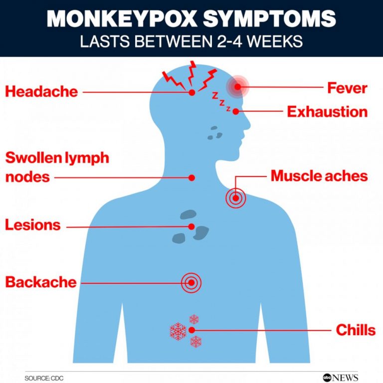 DC reports 1st orthopox, potential monkeypox case