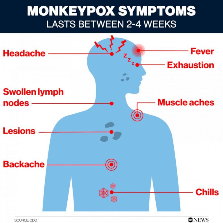 Monkeypox cases up 77% in 1 week: WHO