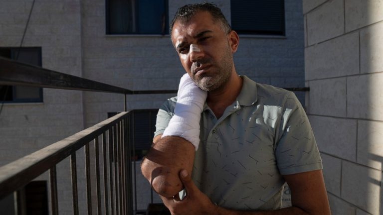 Palestinian man left beaten, bloodied by Israeli police