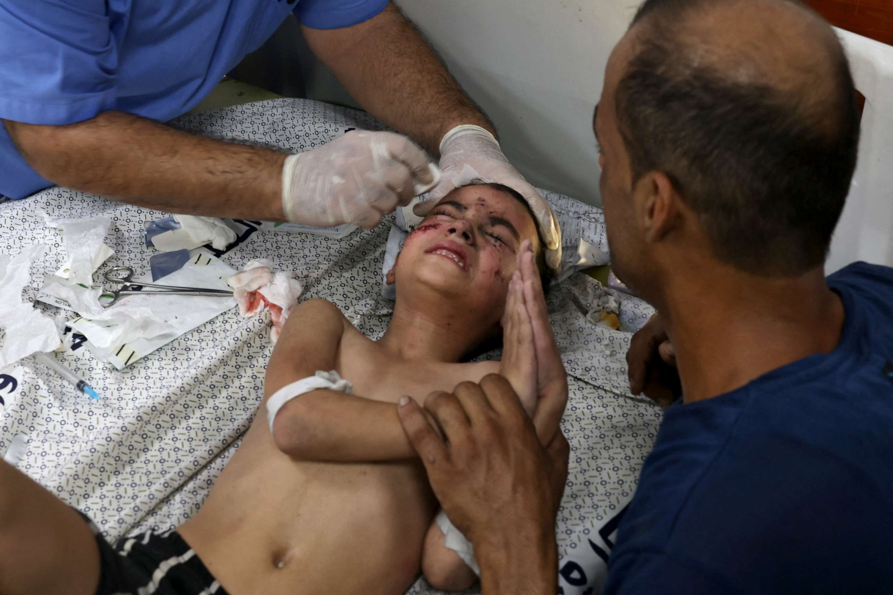 PHOTO: A boy is treated for injuries at a hospital in the city of Rafah, in the southern Gaza Strip, Oct.12, 2023, as battles between Israel and the Hamas movement continue for the sixth consecutive day.