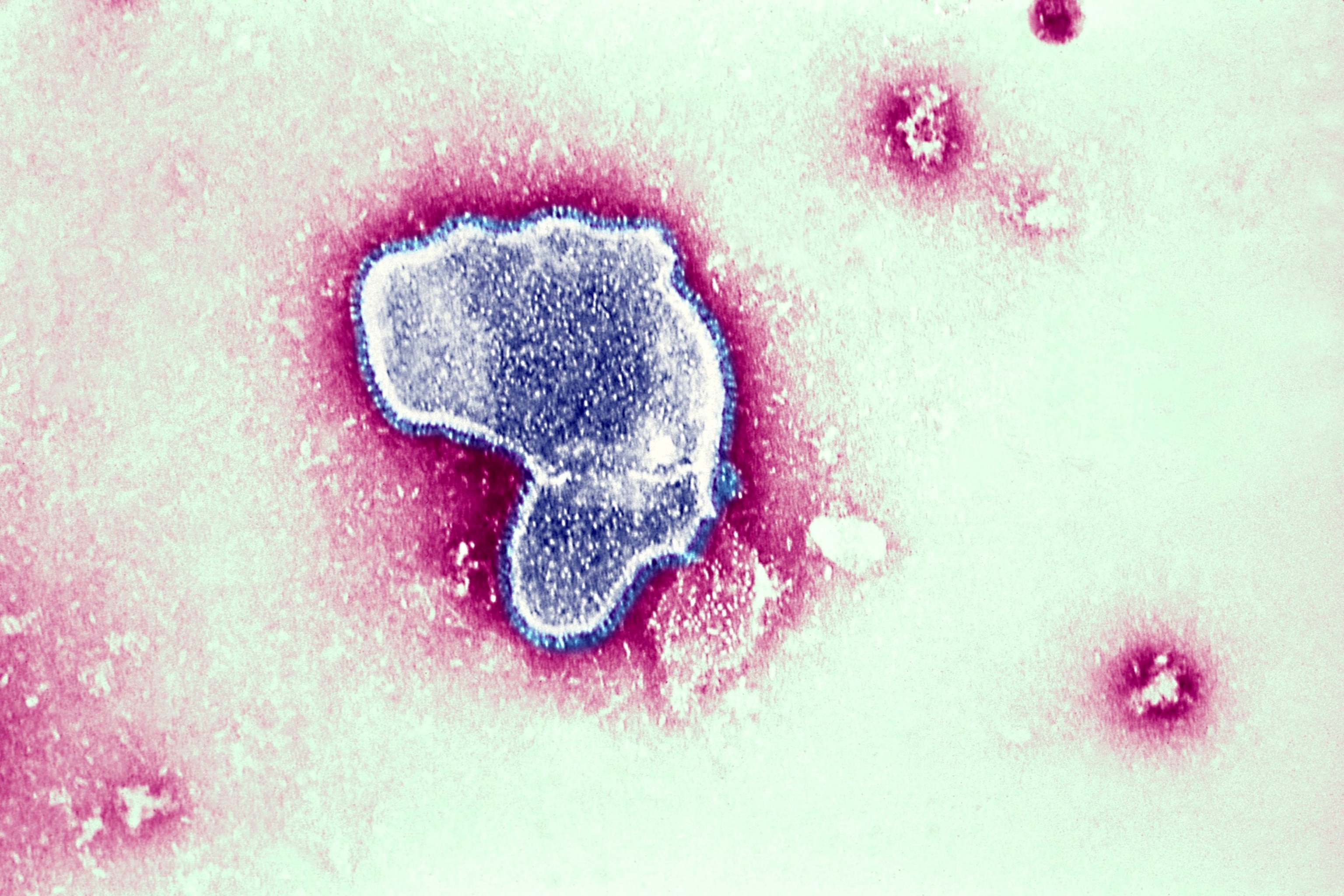 PHOTO: An electron micrograph shows the morphologic traits of the Respiratory Syncytial Virus Rsv.