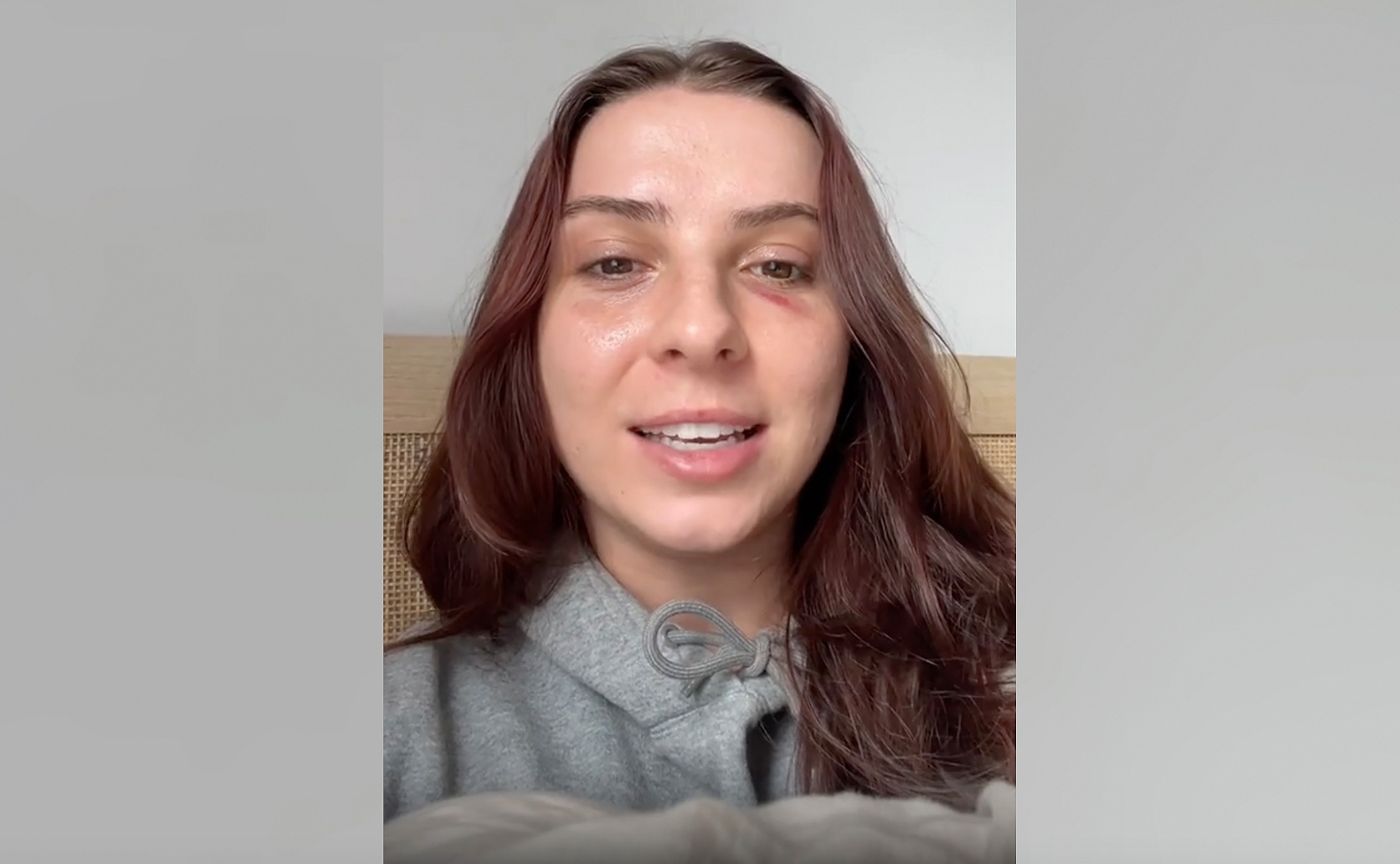 PHOTO: Mikayla Toninato speaks in a posting on her Tik Tok account recounting an incident where she was struck in the face while walking in the streets of New York City.