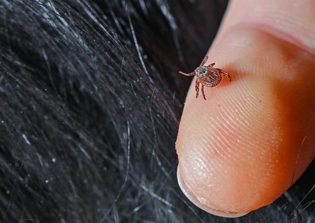 How to spot ticks and get rid of them as warm weather raises risk