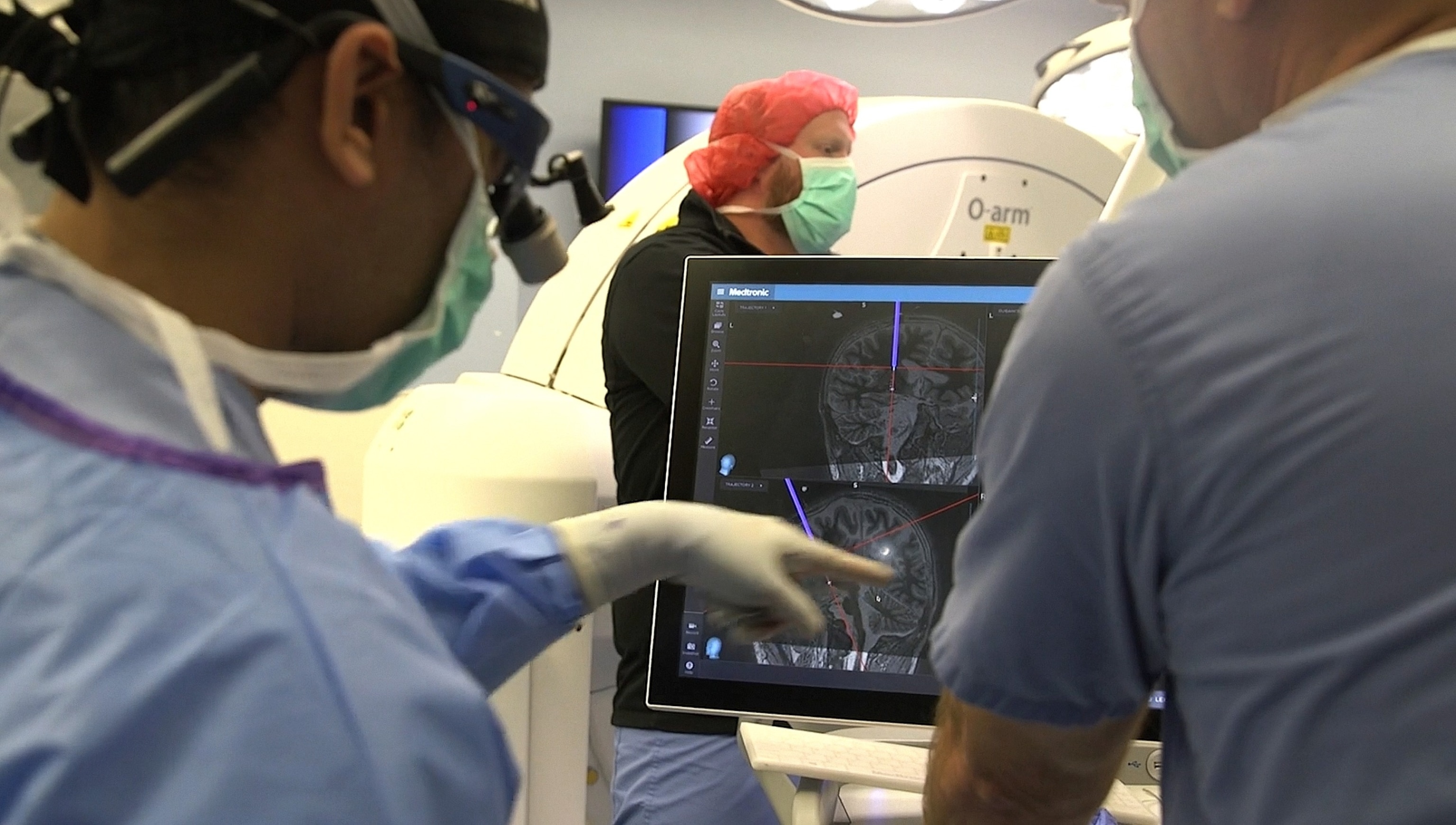 PHOTO: Deep brain stimulation a procedure in which a surgeon implants one or more small electrodes in the brain and a device called a neurostimulator in the upper chest to help treat neurological conditions. 