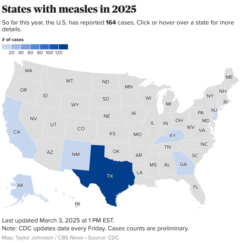 What to know about measles, symptoms and the MMR vaccine